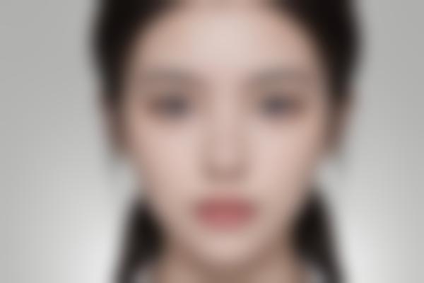 面部轮廓手术：改变脸型的科学艺术