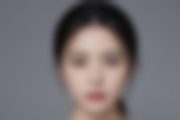 无锡南友谊整形医院怎么样？正规私立机构项目齐全