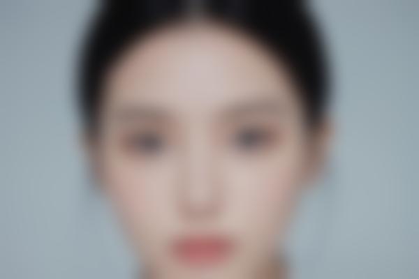 长沙做面部整形选择哪家医院？医生解析面部整形项目及注意事项