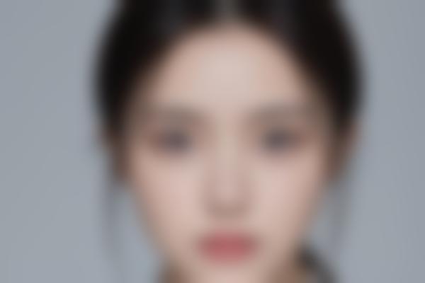骨科手术的选择与注意事项：你需要了解的关键信息