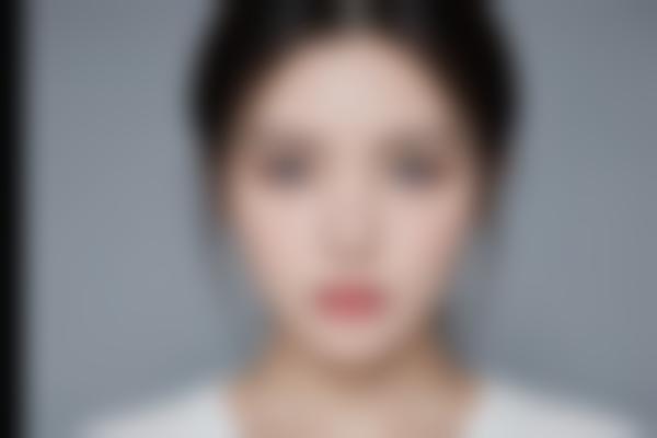 大连哪家诊所祛痘淡斑好？何医生医疗美容诊所技术解析