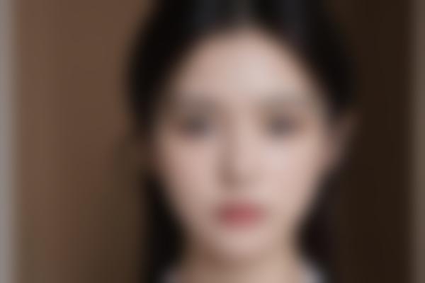光纤技术是什么？它在医美行业的应用