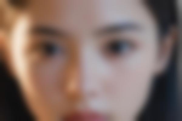 烟台华怡医学美容激光美容手术介绍