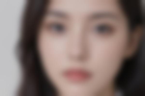 苏州牙齿美容修复吴玉涛医生 种植牙矫正技术解析