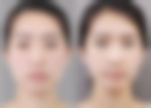 成都青羊雅肤媛的口碑服务，绝绝子