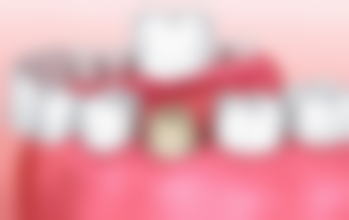 【湖北仙桃牙佳美口腔怎么预约挂号?】