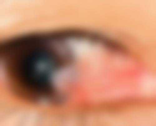 预约挂号：开启清晰视力之旅