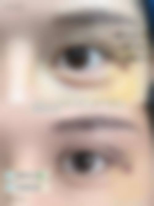 成都青羊雅肤媛时述党医生的技术特色，牛掰格拉斯