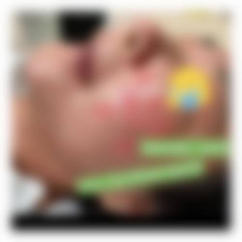 大连爱德丽格医美面部除皱术价格8770元起医院开展该项目的优势