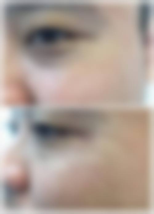 大连爱德丽格医美面部除皱术价格8770元起的医院简介