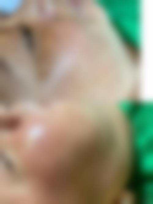 大连爱德丽格医美面部除皱术价格8770元起的预约挂号方式