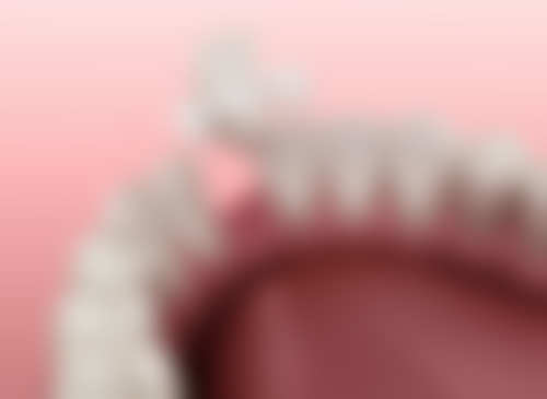 【湖北仙桃牙佳美口腔参考价格表：】