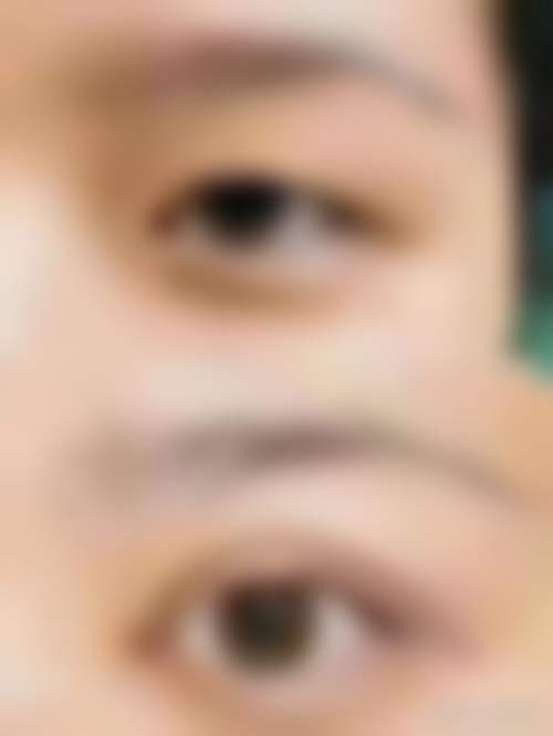 【合肥庐阳星之地整形医院参考价格表：】