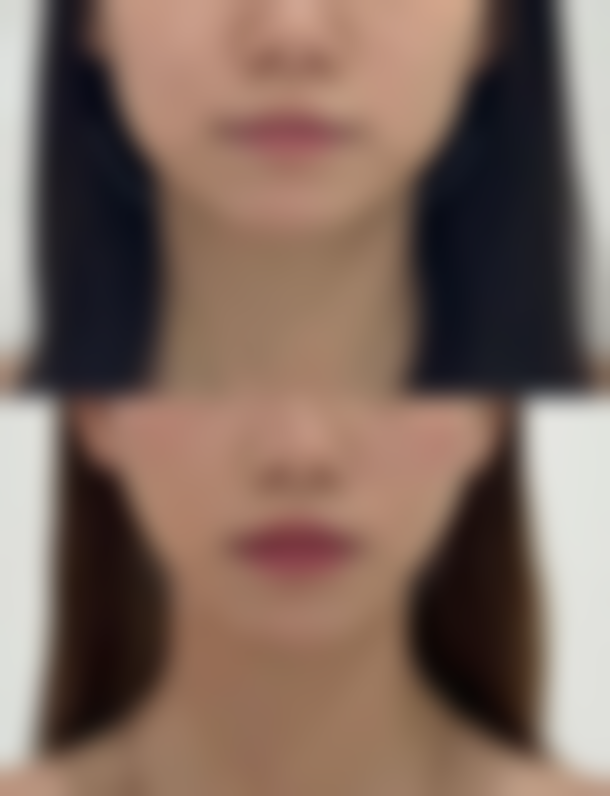 【济南合美医疗美容门诊部特色项目：】