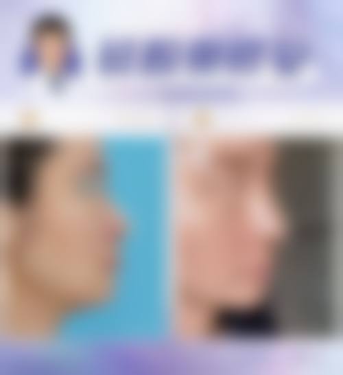 【广州高尚医学美容中 心医生名单：】