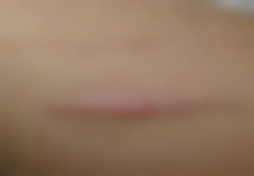 种植头发后多久可以染头发