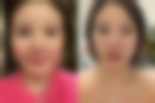 打了瘦脸针可以吃感冒灵吗