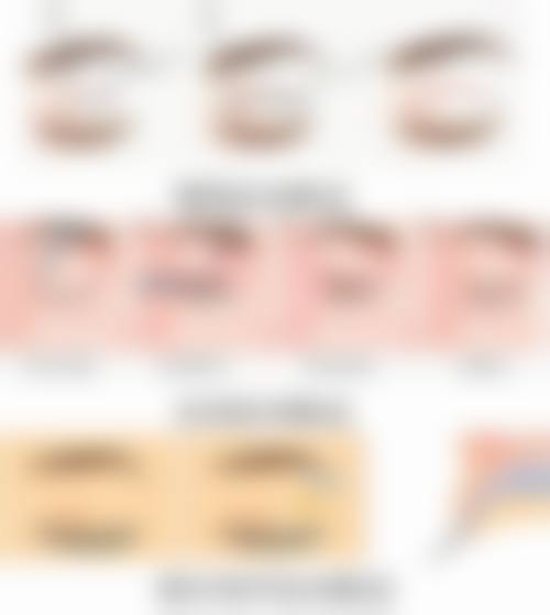 瘦脸针后可以吃感康吗