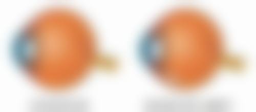 瘦脸针哪里打比较正规