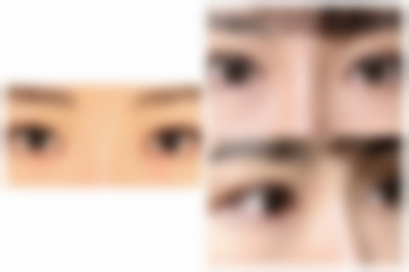 打完瘦脸针能吃感康吗