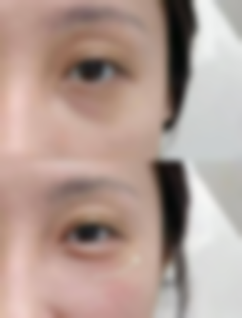 天生圆脸怎么办