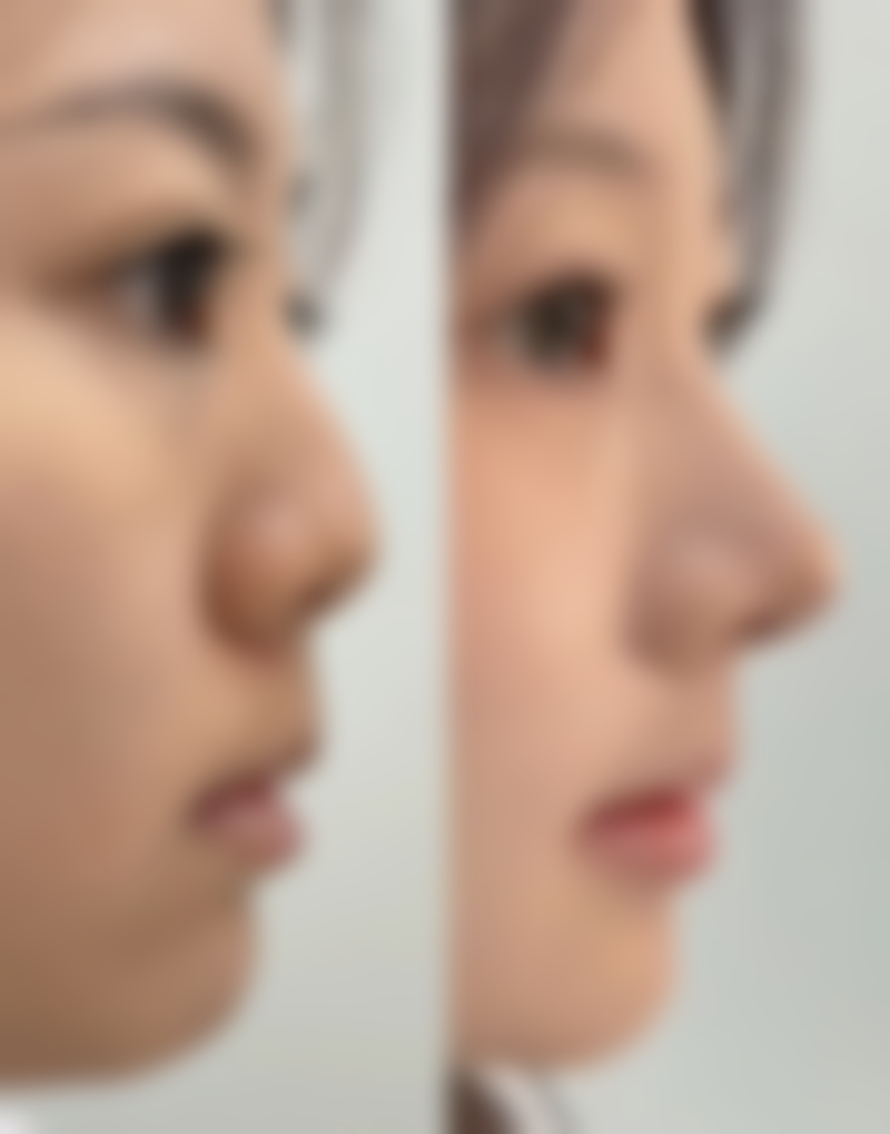 【深圳百富美美容门诊部地址：】