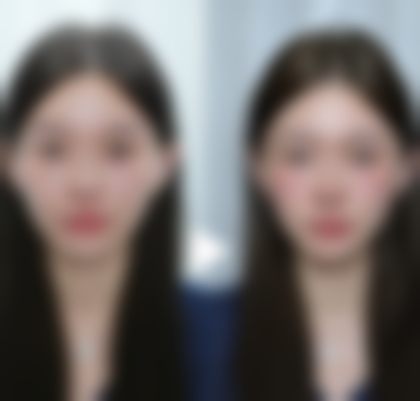 牙龈后面 舌头下面 口腔 白色凸起是怎么回事