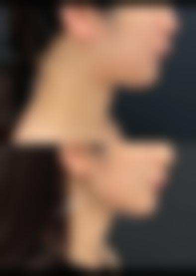 【驻马店阮夏君医疗美容诊所患者口碑评价：】