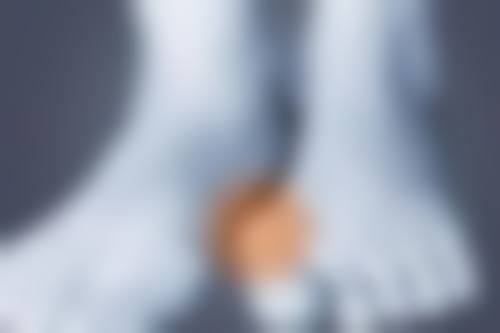 注射丰太阳穴的风险及应对