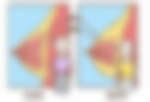 不同人群适合的除皱方法