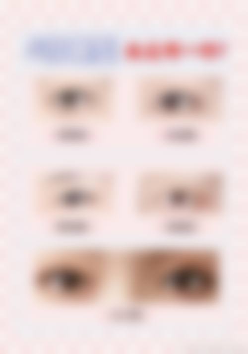 【黎帅医生口碑怎么样？】