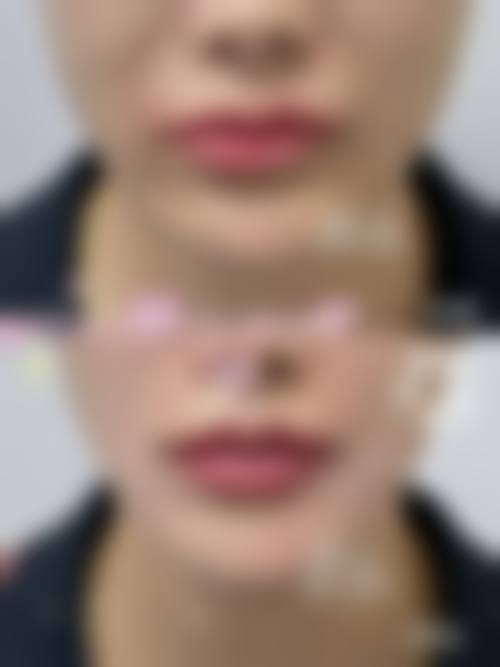 【韩国拉菲安整形外科诊疗设备：】