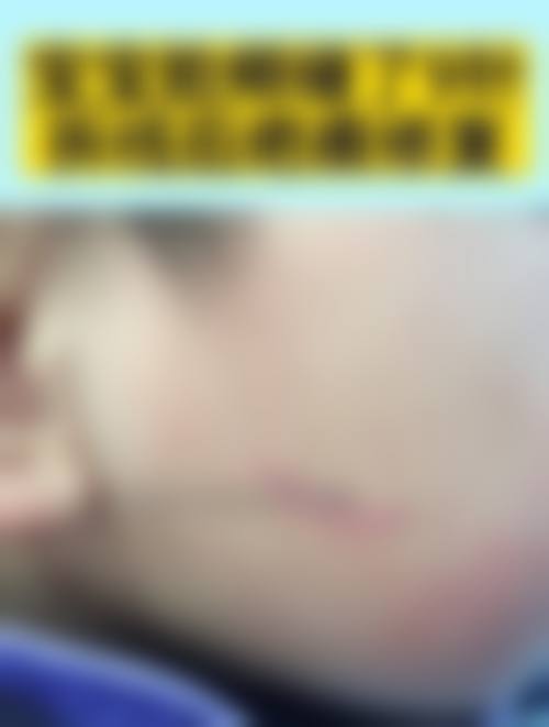 【韩国拉菲安整形外科患者口碑评价：】