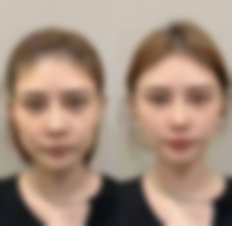 【森秀人医生擅长项目】