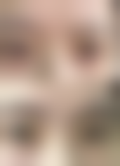 【罗勇福医生技术特点】