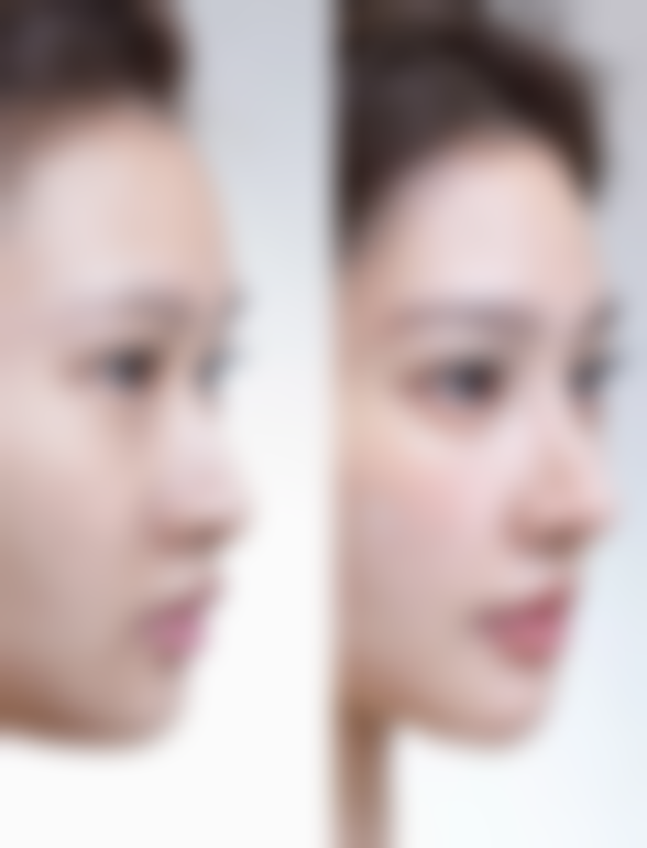 【滕召勇医生擅长项目】