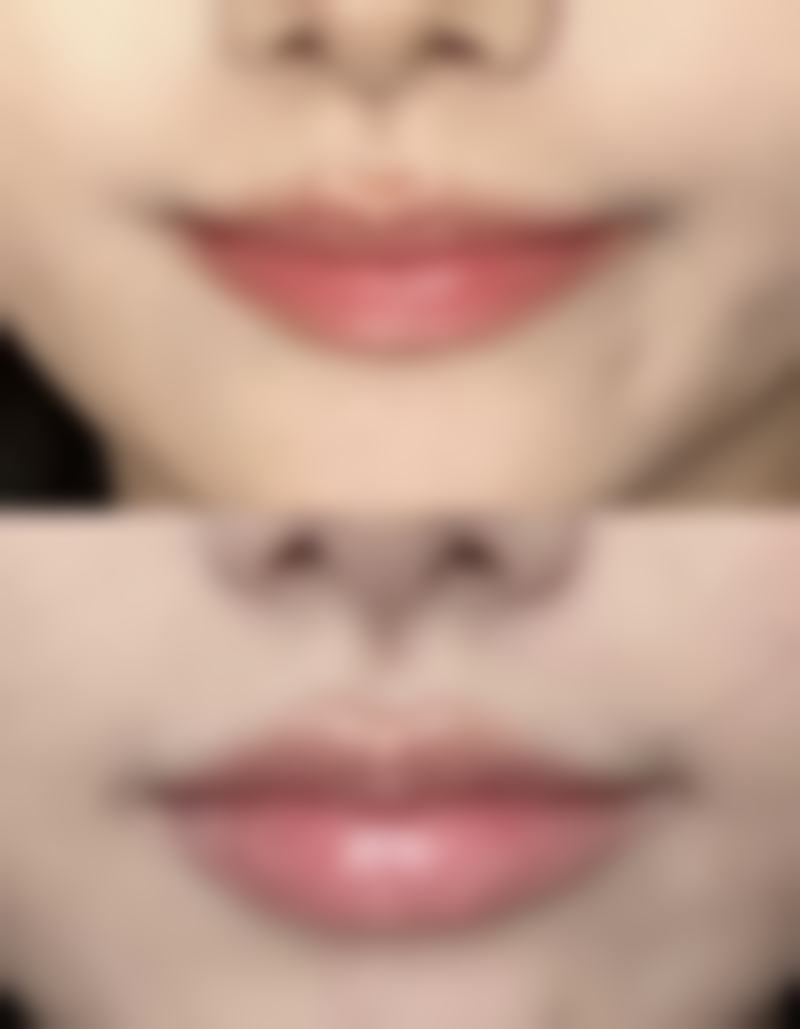 嘴突出平时怎么改善