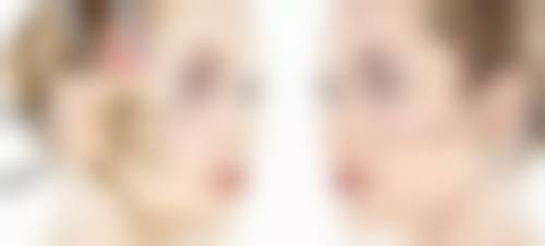 打美白针能白吗