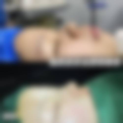 【郑州菲林眼鼻修复中 心地址：】