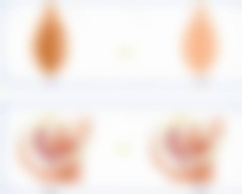 【深圳克拉芙医疗美容诊所是正规的吗?】