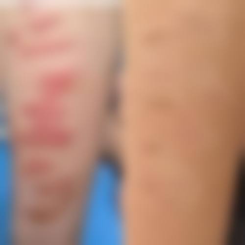 【兰州华美整形医院是正规的吗?】