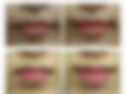 做完皮秒为什么斑越来越重度