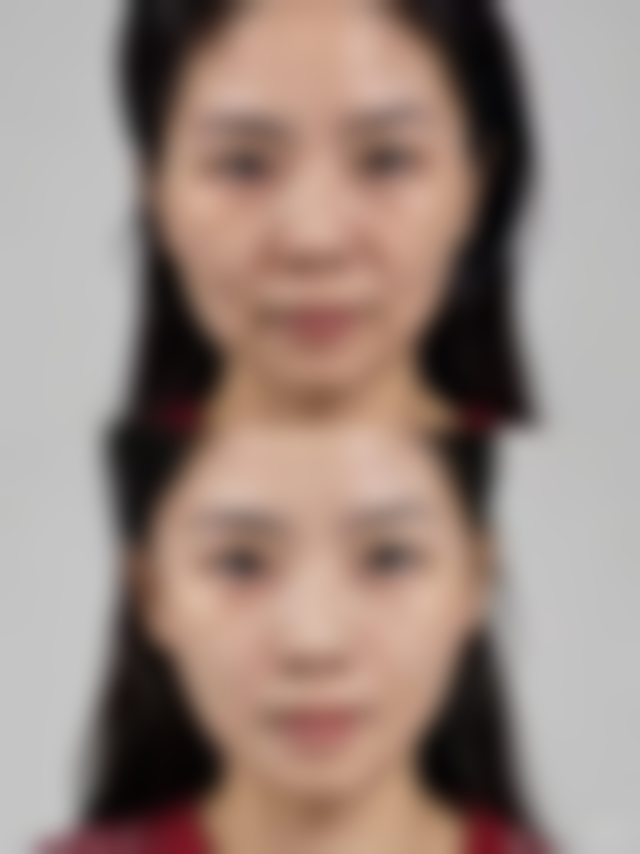 【广州飞悦整形医疗美容医院怎么预约挂号?】