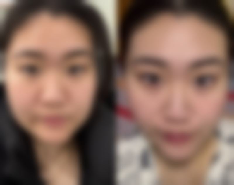 【广州韩式千玺医疗美容门诊部患者口碑评价：】