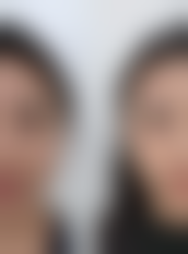 【滕召勇医生口碑怎么样？】