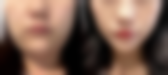 【广州飞悦整形医疗美容医院特色项目：】