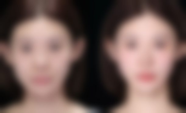 九、瘦脸针去哪里打