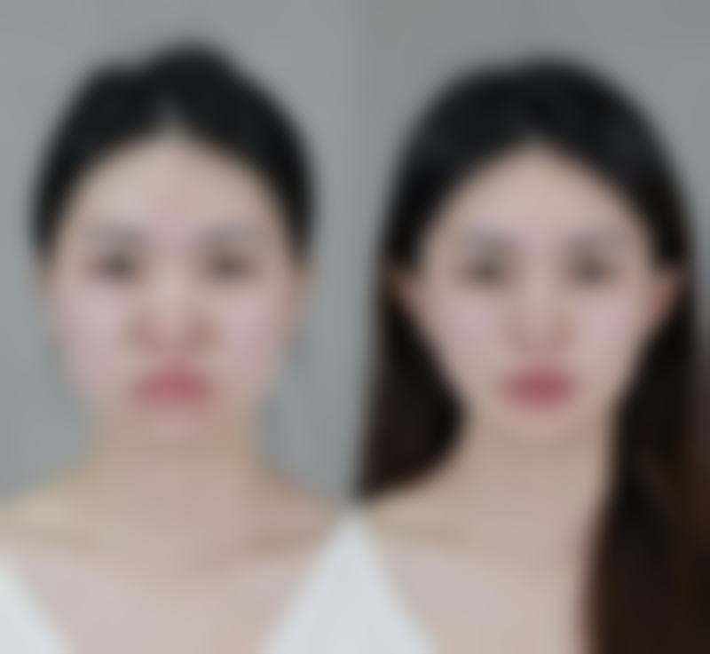 【森秀人医生擅长项目：】