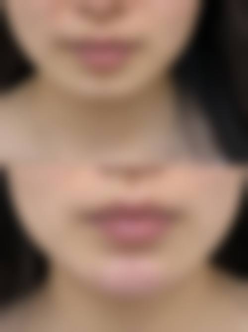 【张志庆医生擅长项目】