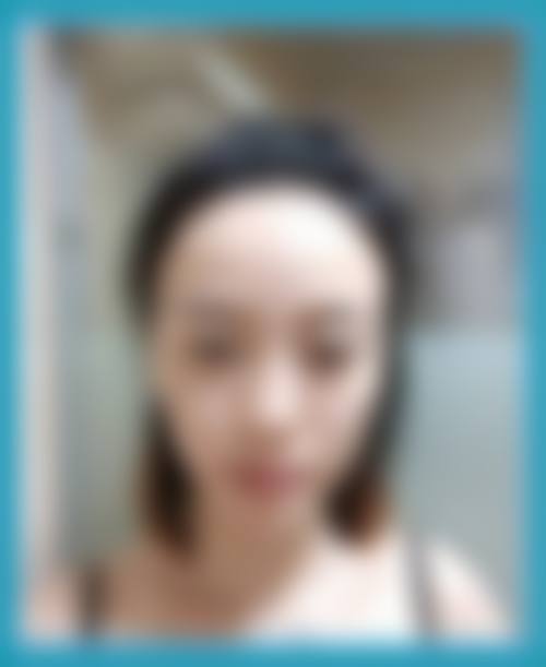 【张志庆医生怎么预约挂号?】